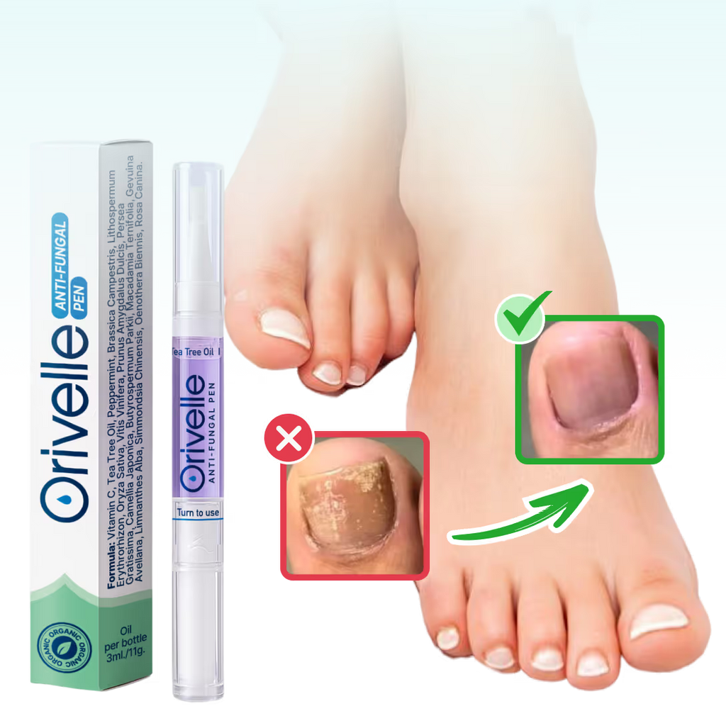 A Natural Way to Eliminate Nail Fungus – For Good