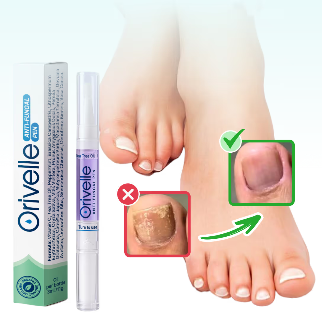 A Natural Way to Eliminate Nail Fungus – For Good