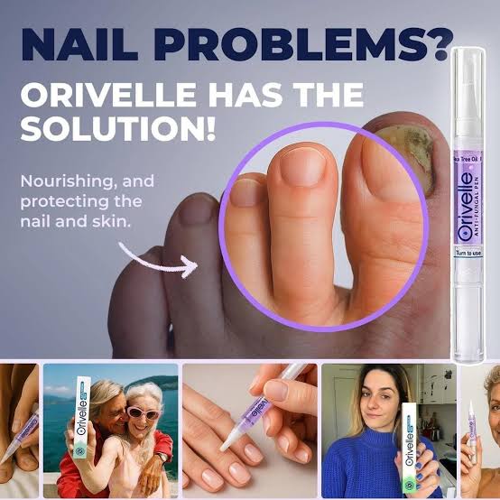 A Natural Way to Eliminate Nail Fungus – For Good